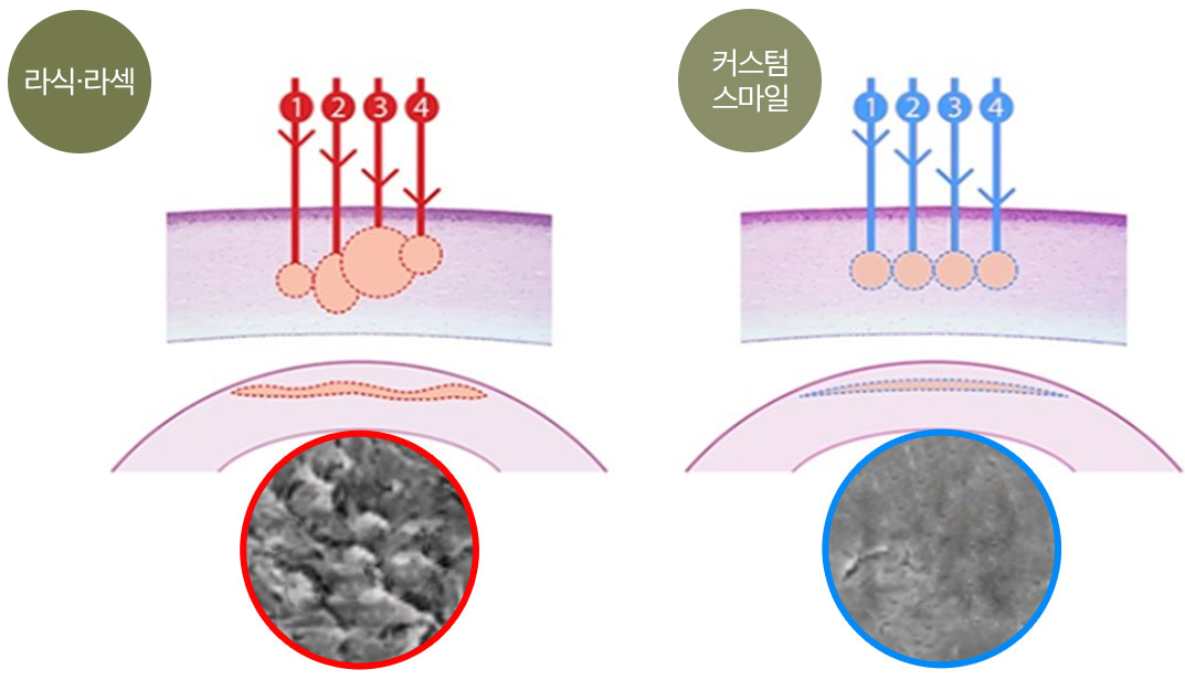 작은 레이저 빔